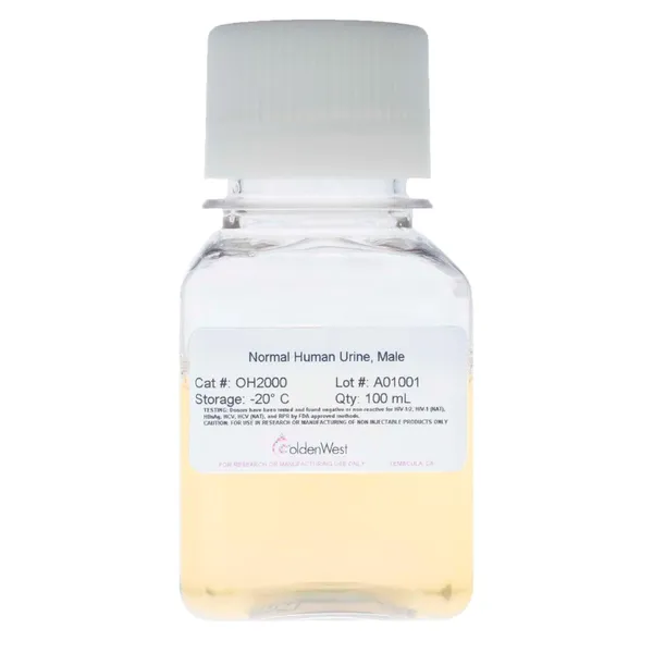 OH2000: Normal Human Urine, Male