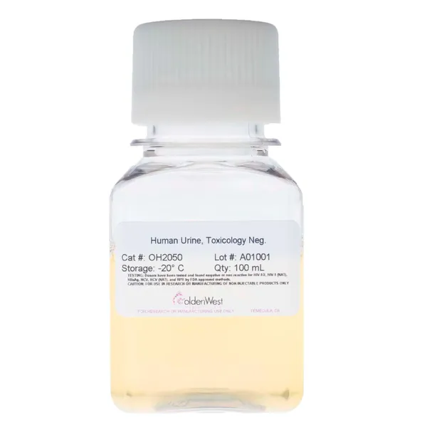 OH2050: Human Urine, Toxicology Negative