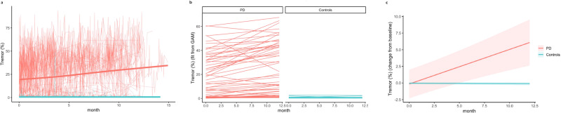 WATCH-PD study Figure 2: smartwatch-measured tremor percentage over 12 months in Parkinson's disease patients (red) versus controls (blue), showing progressive increase in PD group